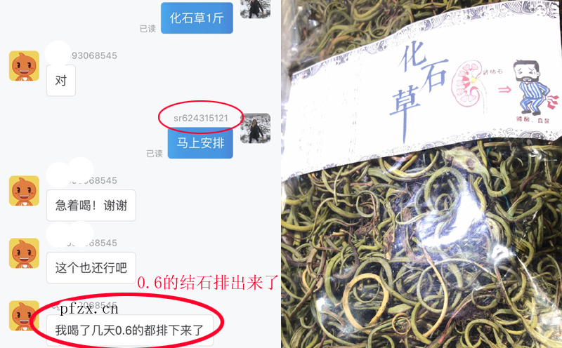 化石草有效排石案例圖片 化石草有效排石案例圖片